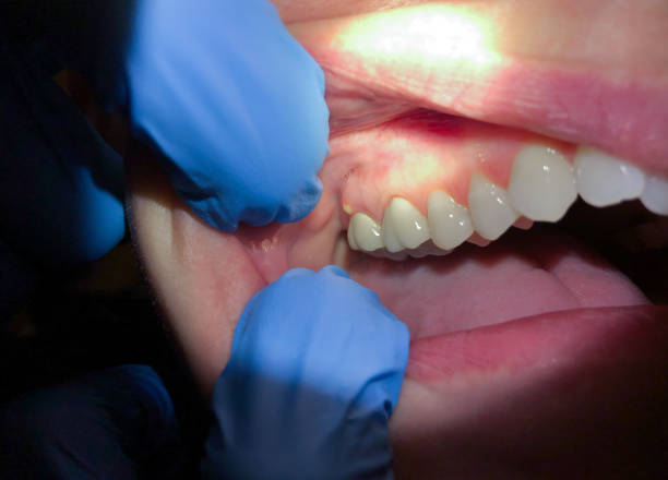 Best Orthodontic Emergency Dentist in Kewaskum, WI